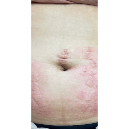 CODEX LABS KĀNGFÙ Cooling Recovery Gel